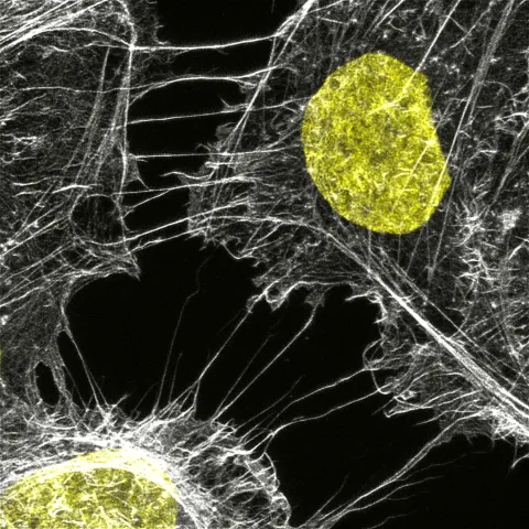 Cancer & Cell Biology